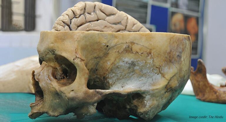The World's First Museum of the Mind and Brain Will Be Established By ...