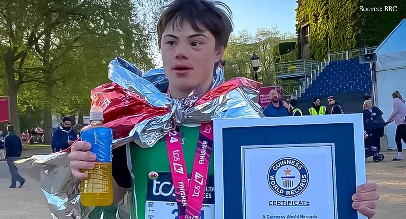 Down's Syndrome