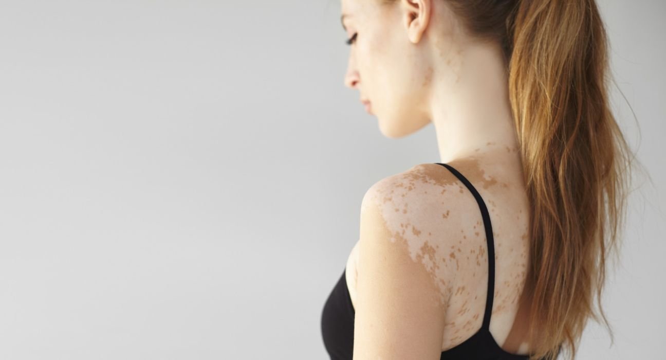 living-with-the-body-scar