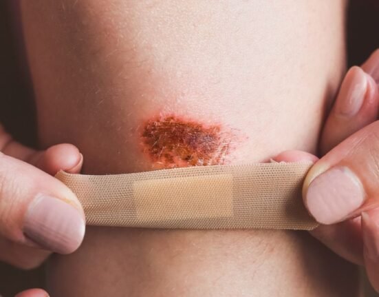 non-suicidal-self-injury-nssi-as-a-coping-mechanism
