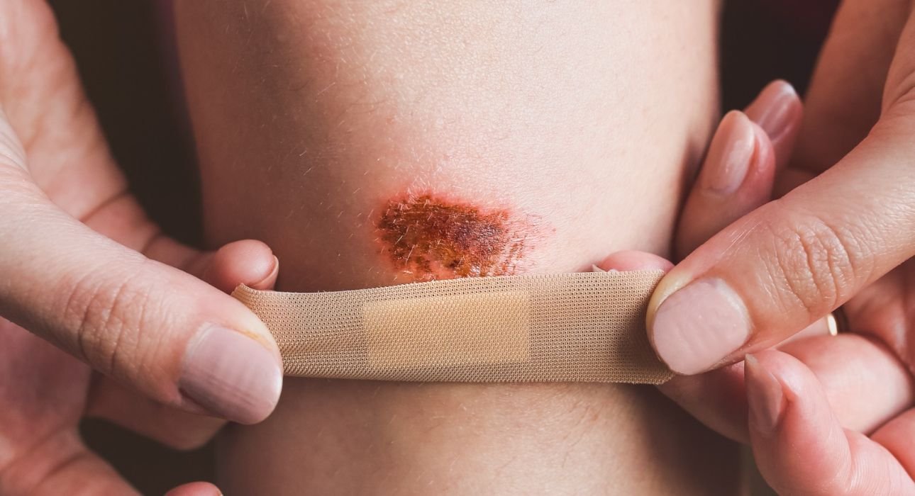 non-suicidal-self-injury-nssi-as-a-coping-mechanism