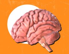 cortical-thinning-caused-by-chronic-stress-exposure