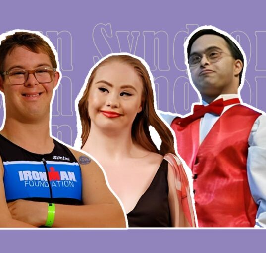 redefining-ability-in-down-syndrome-how-society-shapes-inclusion-and-opportunity