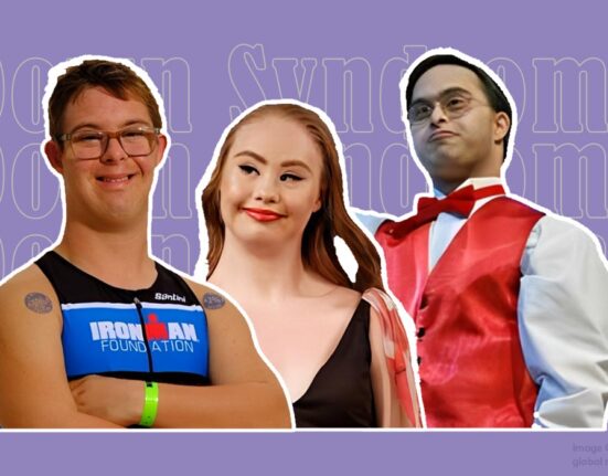 redefining-ability-in-down-syndrome-how-society-shapes-inclusion-and-opportunity