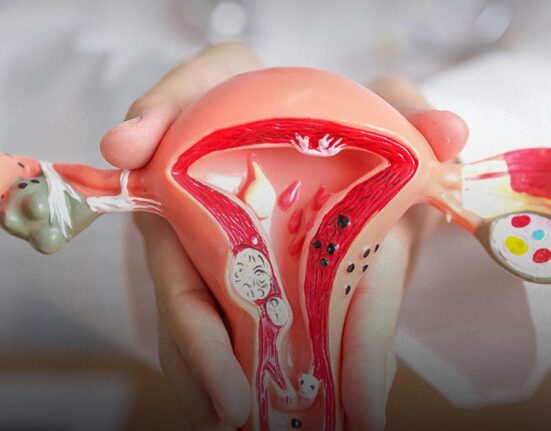 pcos-renamed-as-pmos-in-major-global-shift-in-womens-health-terminology