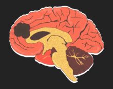 a-new-hope-against-brain-cancer-how-personalised-dna-vaccines-are-changing-glioblastoma-treatment