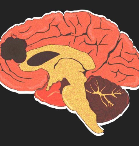 a-new-hope-against-brain-cancer-how-personalised-dna-vaccines-are-changing-glioblastoma-treatment