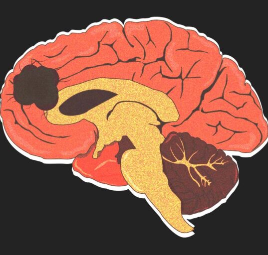 a-new-hope-against-brain-cancer-how-personalised-dna-vaccines-are-changing-glioblastoma-treatment