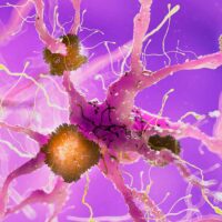alzheimers-combination-therapy-targeting-amyloid-and-tau-proteins