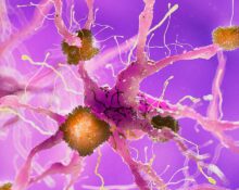 alzheimers-combination-therapy-targeting-amyloid-and-tau-proteins