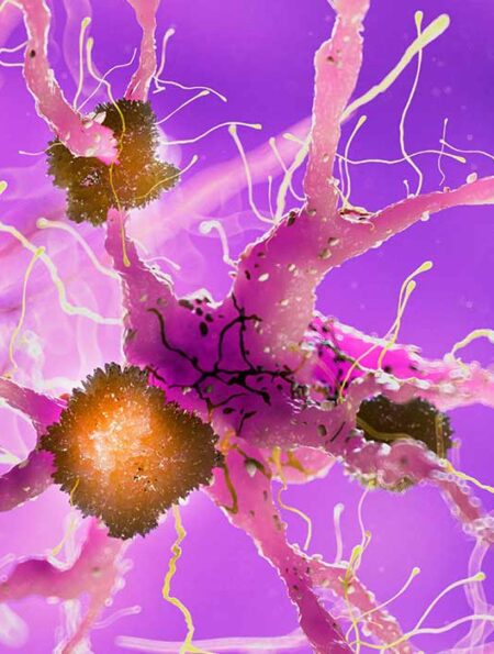 alzheimers-combination-therapy-targeting-amyloid-and-tau-proteins