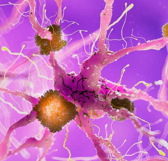 alzheimers-combination-therapy-targeting-amyloid-and-tau-proteins