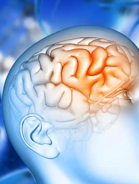 examining-brain-immune-cells-in-alzheimers-disease-progression