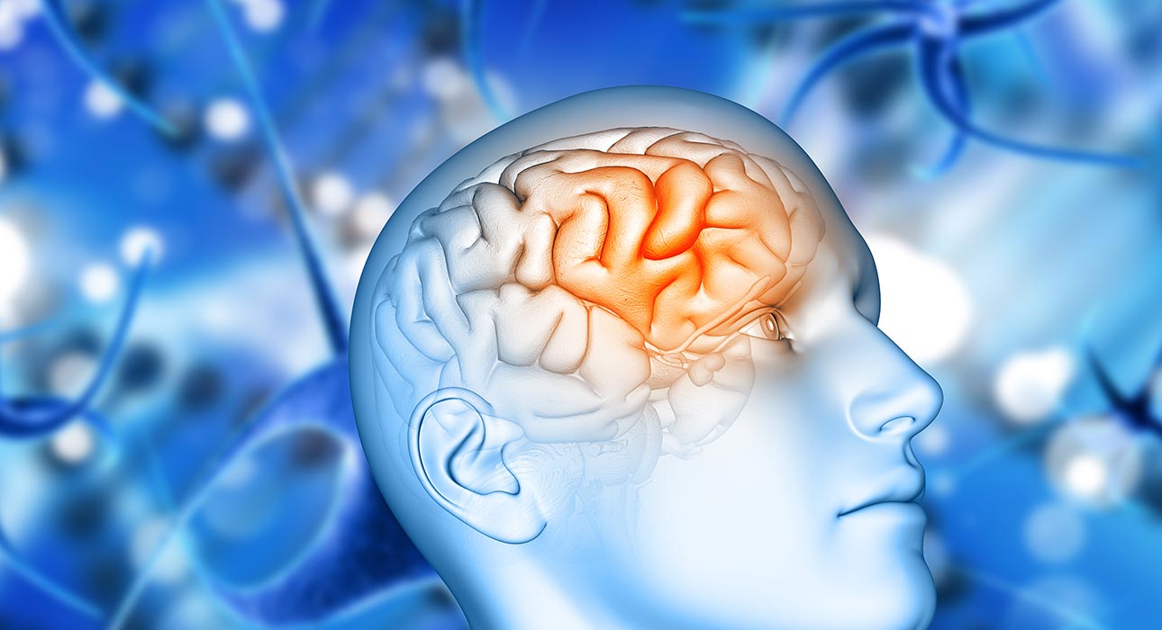 examining-brain-immune-cells-in-alzheimers-disease-progression