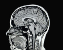 hetairos-ai-predicts-brain-tumour-molecular-subtypes-in-12-minutes