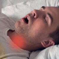how-snoring-may-damage-throat-muscles-and-cause-sleep-apnea