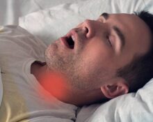 how-snoring-may-damage-throat-muscles-and-cause-sleep-apnea