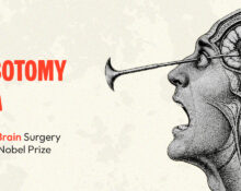 the-lobotomy-era-when-brain-surgery-won-a-nobel-prize