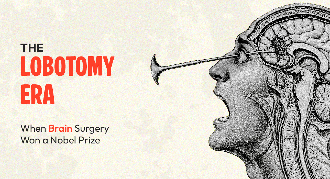 the-lobotomy-era-when-brain-surgery-won-a-nobel-prize